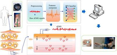 Estimation of the Continuous Pronation–Supination Movement by Using Multichannel EMG Signal Features and Kalman Filter: Application to Control an Exoskeleton